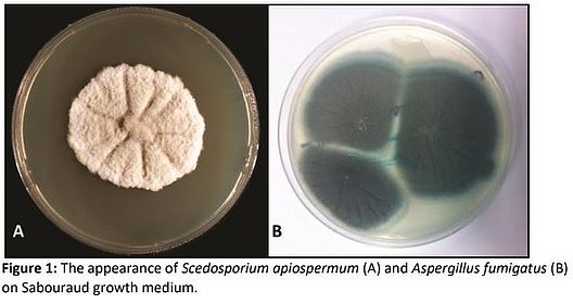 Abbildung 1: Das Vorkommen von Scedosporium apiospermum (A) und Aspergillus fumigatus in Sabouraud Wachstumsmedium.