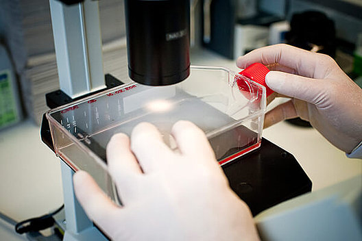 Stammzellenforscher Professor Dr. Ulrich Martin von der Medizinischen Hochschule Hannover forschte in einem vom Mukoviszidose e.V. unterstützten Forschungsprojekt daran, entnommene Blutzellen im Labor umzuprogrammieren und für die Testung von neuen Wirkstoffen einzusetzen. Auf dem Bild sieht man die mikroskopische Kontrolle der in Zellkultur gewachsenen Stammzellen. 