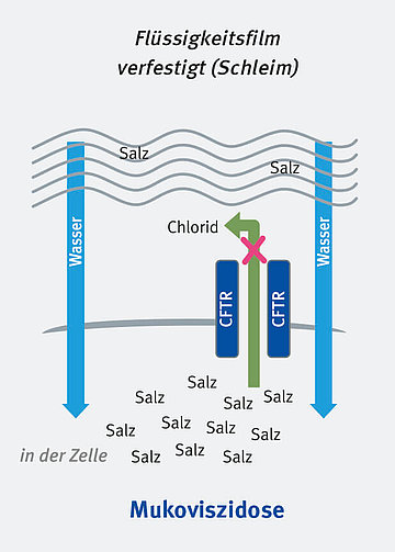 Schematische Darstellung der Funktion des CFTR-Kanals bei Mukoviszidose. Durch den gestörten Kanal bleibt mehr Salz in der Zelle, so dass Wasser in die Zelle strömt und überall ein zähflüssiger Schleim bildet. 