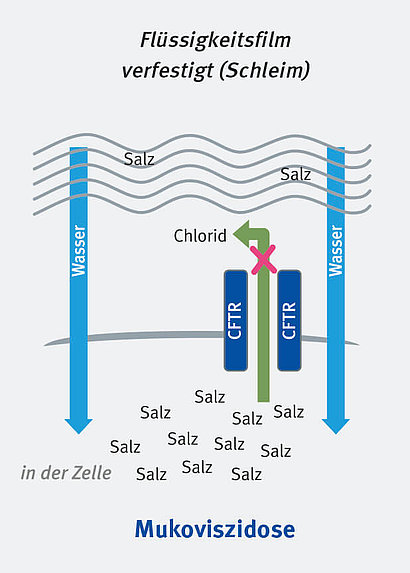 Schematische Darstellung der Funktion des CFTR-Kanals bei Mukoviszidose. Durch den gestörten Kanal bleibt mehr Salz in der Zelle, so dass Wasser in die Zelle strömt und überall ein zähflüssiger Schleim bildet. 