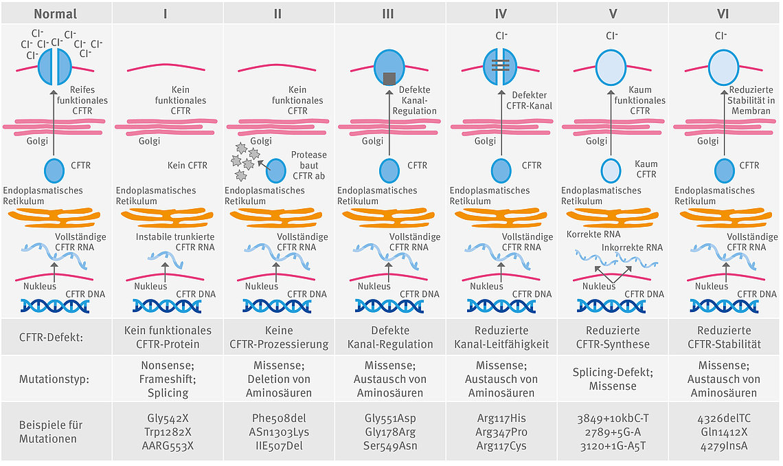 Mutationsklassen bei Mukoviszidose