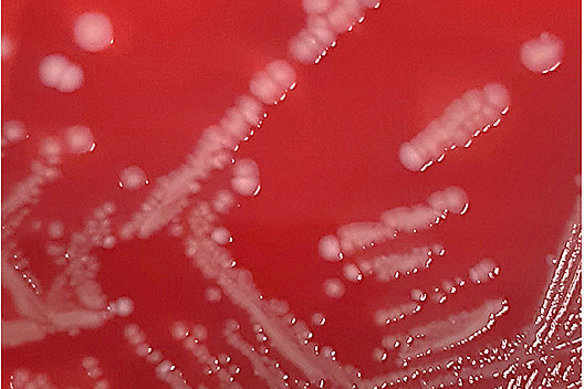 Staphylococcus aureus Kolonien auf Blutagarplatten.