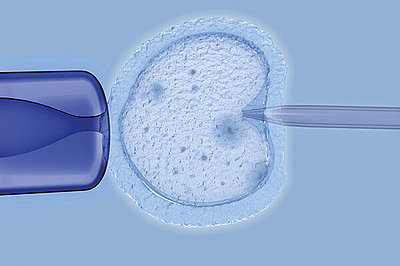 Bei einer ICSI wird das Spermium direkt in die reife Eizelle injiziert.