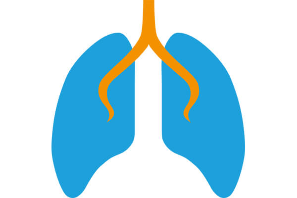 Lunge (stilisiert): Bei den meisten Mukoviszidose-Patienten ist die Lunge betroffen.